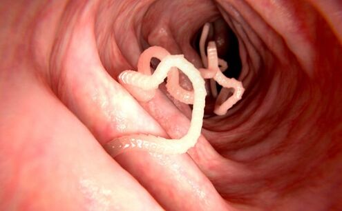 Vers dans le corps humain