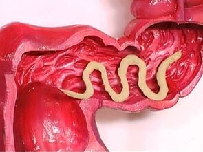 parasites dans le corps humain parce qu'ils apparaissent