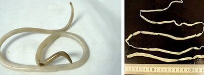 types de parasites dans le corps humain